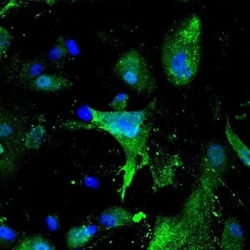 Claudin-1 Antibody - BSA Free, Novus Biologicals 0.1mg; Unlabeled:Antibodies,